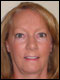 Nancy Widener